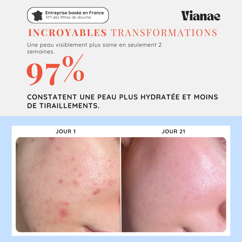 Tête De Douche Filtrante Vianae